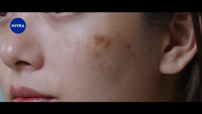 ใหม่! จัดการฝ้าเฉพาะจุด ด้วย นีเวีย ลูมินัส 630 ดีพ สปอต